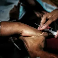 Zbliżenie na rękę, której żyła jest uciskana, a igła wkłuwana do pobrania krwi. Widoczny jest wenflon i rurka.