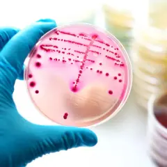 Enterococcus faecalis w nasieniu: Jak leczyć tę bakterię?