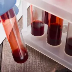 Badanie krwi po antybiotyku - o czym należy pamiętać?