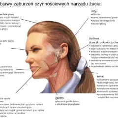 Anatomia twarzy z zaznaczonymi objawami parafunkcji narządu żucia: bóle głowy, oczu, uszu, stawu skroniowo-żuchwowego, jamy ustnej, szyi, gardła i zębów.