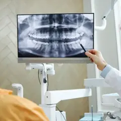 Czy pantomogram jest na NFZ? Sprawdź, co musisz wiedzieć przed badaniem