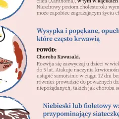 Ilustracja przedstawia twarz z wysypką i popękanymi ustami, objawy mogące wskazywać na najczęstsze choroby serca.