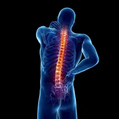 Ból kręgosłupa, który może być objawem osteoartrozy. Co to jest i jak sobie z tym radzić?