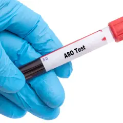 Ręka w niebieskiej rękawiczce trzyma probówkę z napisem "ASO Test". Wysokie ASO może wskazywać na infekcję, a niekoniecznie na nowotwór.