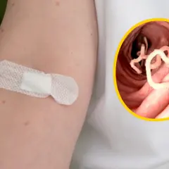 Ramię z plastrem i zbliżenie na jelito z pasożytami układu pokarmowego.