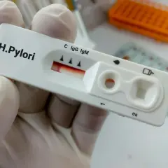 Opinie o leczeniu Helicobacter pylori: Forum dyskusyjne