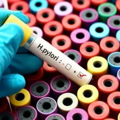 Jak wykryć Helicobacter pylori? Kluczowe badania dla Twojego zdrowia