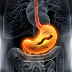 Helicobacter pylori w kale: Co oznacza pozytywny wynik testu?