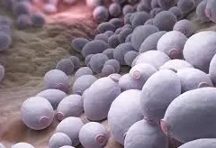 Candida - jakie objawy wskazują na zakażenie grzybicze?