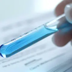 Test oddechowy na Helicobacter pylori: Jak to działa i kiedy stosować?