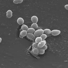 Enterococcus faecalis w moczu: Jak leczyć? Skuteczne metody