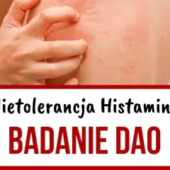 Niedobór DAO: jakie są objawy i jak diagnozować ten stan?