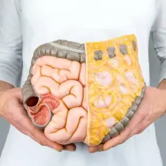 Lactobacillus plantarum 299v w terapii SIBO: Efekty i zastosowanie