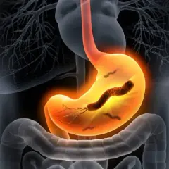 Ile kosztuje badanie na Helicobacter pylori? Ceny w całej Polsce
