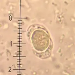 Blastocystis hominis - charakterystyka, objawy i naturalne leczenie