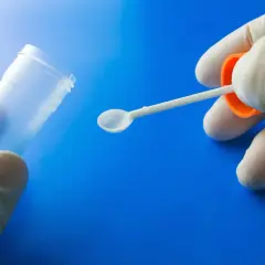 Ile kosztuje badanie kału na pasożyty? Ceny w różnych laboratoriach