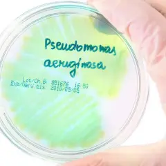 Pseudomonas aeruginosa w moczu: Co oznacza dla Twojego zdrowia?