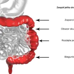 Zespół jelita drażliwego: jakie badania są kluczowe dla diagnozy?