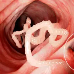 Pasożyty jelitowe - jakie badania wykonać w diagnostyce?