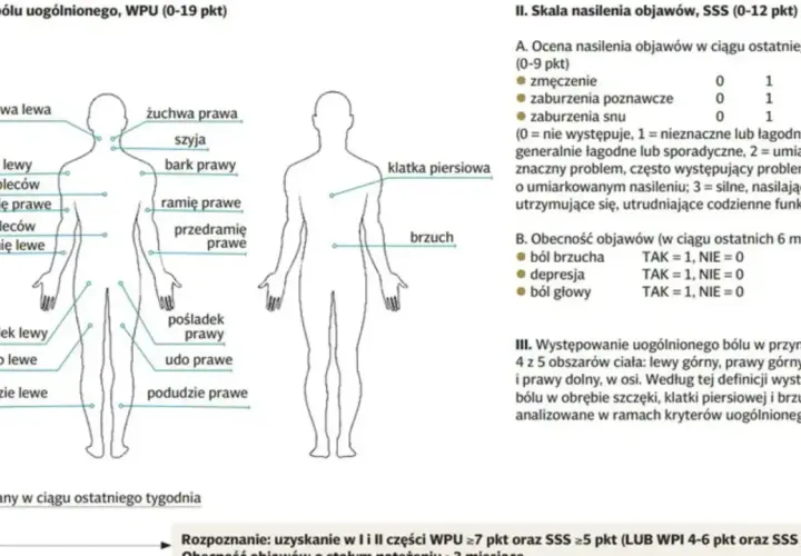 Schemat pokazuje, gdzie fibromialgia boli: żuchwa, szyja, bark, górna i dolna część pleców, ramię, przedramię, klatka piersiowa, brzuch, pośladek, udo, podudzie.