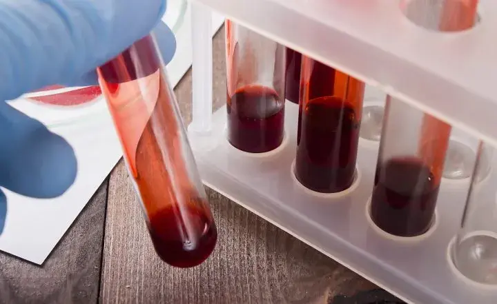 Badanie krwi po antybiotyku - o czym należy pamiętać?