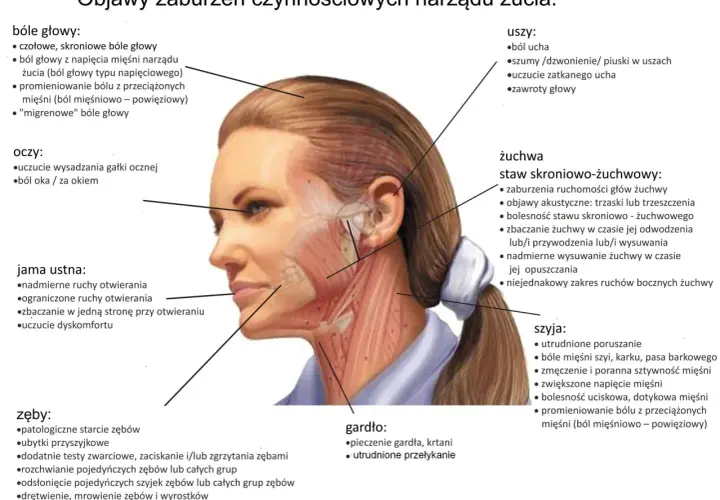 Anatomia twarzy z zaznaczonymi objawami parafunkcji narządu żucia: bóle głowy, oczu, uszu, stawu skroniowo-żuchwowego, jamy ustnej, szyi, gardła i zębów.