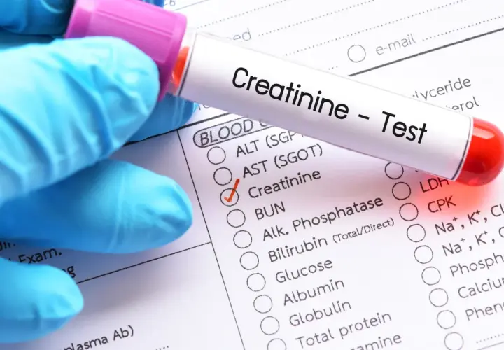Rękawiczka w niebieskiej rękawiczce trzyma probówkę z napisem "Creatinine - Test". Obok zaznaczono "Creatinine" na formularzu badania krwi.