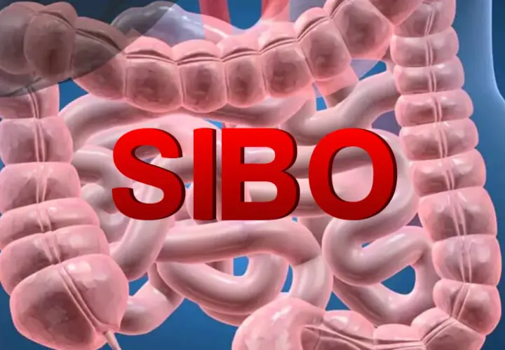 SIBO: przerost flory bakteryjnej i jego skutki dla zdrowia.