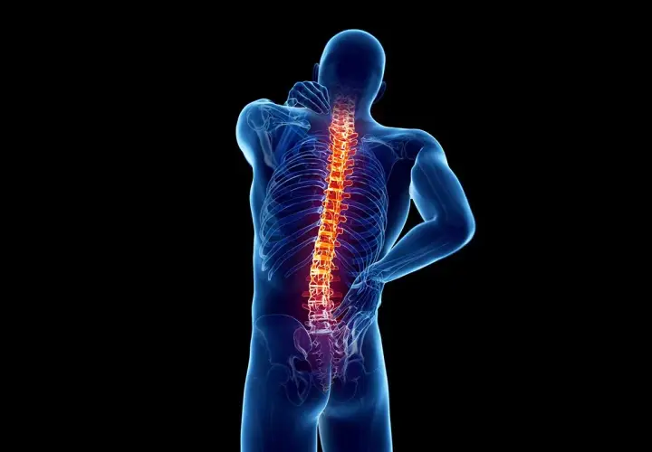 Ból kręgosłupa, który może być objawem osteoartrozy. Co to jest i jak sobie z tym radzić?