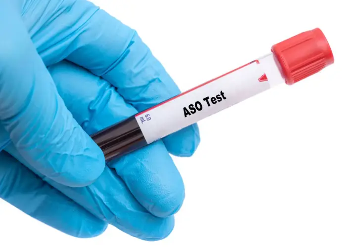 Ręka w niebieskiej rękawiczce trzyma probówkę z napisem "ASO Test". Wysokie ASO może wskazywać na infekcję, a niekoniecznie na nowotwór.