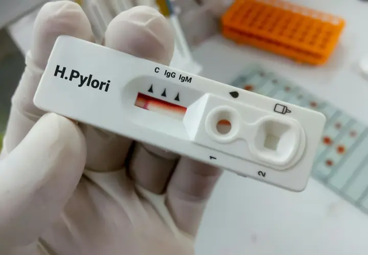Opinie o leczeniu Helicobacter pylori: Forum dyskusyjne
