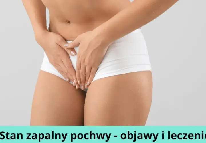 Stan zapalny pochwy: 5 głównych przyczyn i skuteczne leczenie