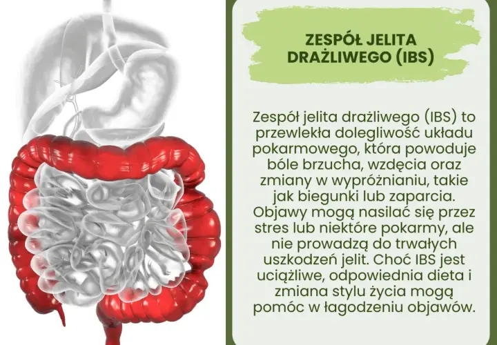 Jelito drażliwe - charakterystyczne objawy zespołu
