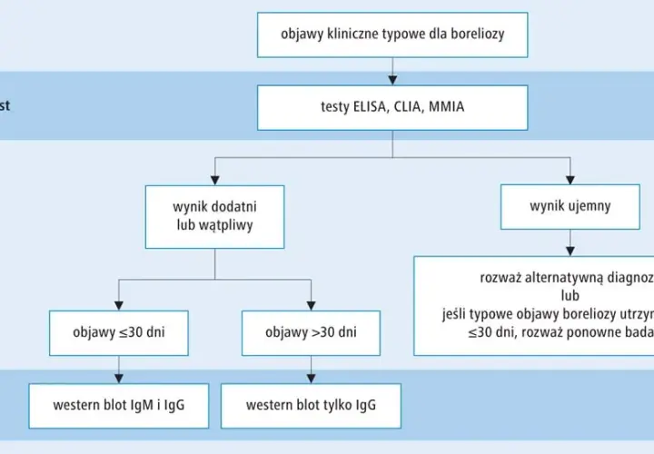 Metoda CLIA: jak działa i dlaczego jest tak ważna w diagnostyce?