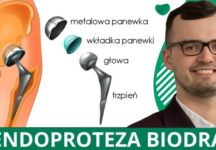 Jakie badania przed operacją endoprotezy: uniknij nieprzyjemnych niespodzianek