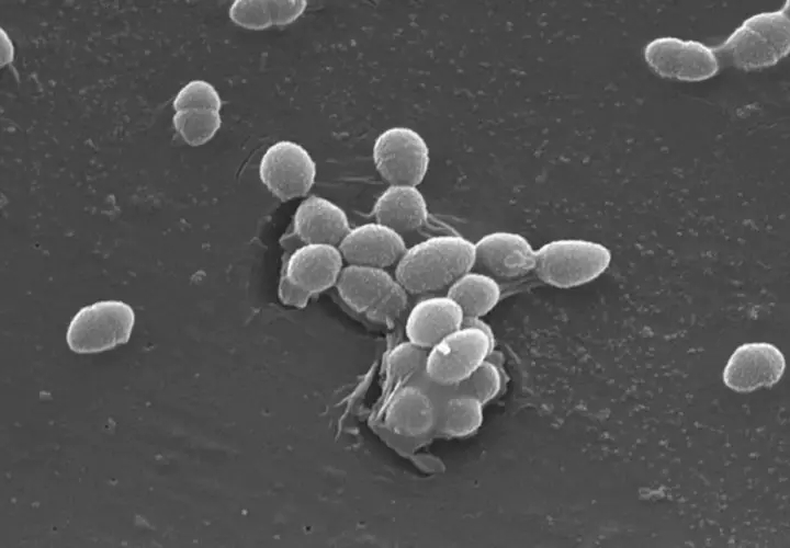 Enterococcus faecalis w moczu: Jak leczyć? Skuteczne metody