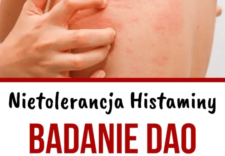 Niedobór DAO: jakie są objawy i jak diagnozować ten stan?