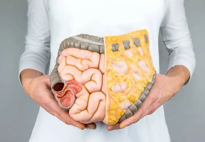 Lactobacillus plantarum 299v w terapii SIBO: Efekty i zastosowanie