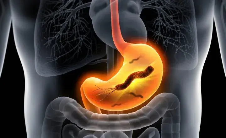 Ile kosztuje badanie na Helicobacter pylori? Ceny w całej Polsce