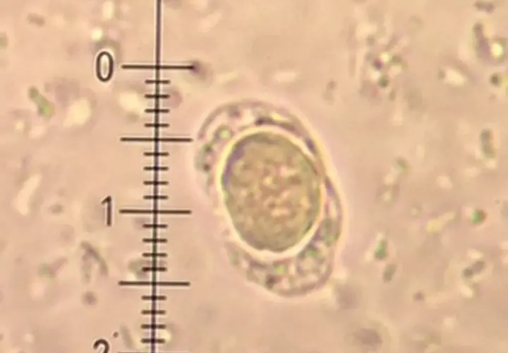 Blastocystis hominis - charakterystyka, objawy i naturalne leczenie
