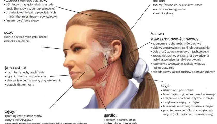 Anatomia twarzy z zaznaczonymi objawami parafunkcji narządu żucia: bóle głowy, oczu, uszu, stawu skroniowo-żuchwowego, jamy ustnej, szyi, gardła i zębów.