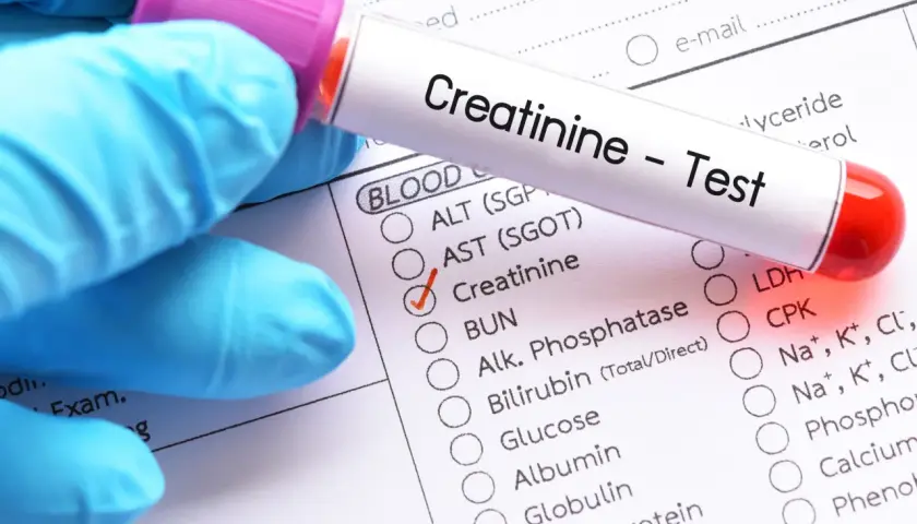 Rękawiczka w niebieskiej rękawiczce trzyma probówkę z napisem "Creatinine - Test". Obok zaznaczono "Creatinine" na formularzu badania krwi.