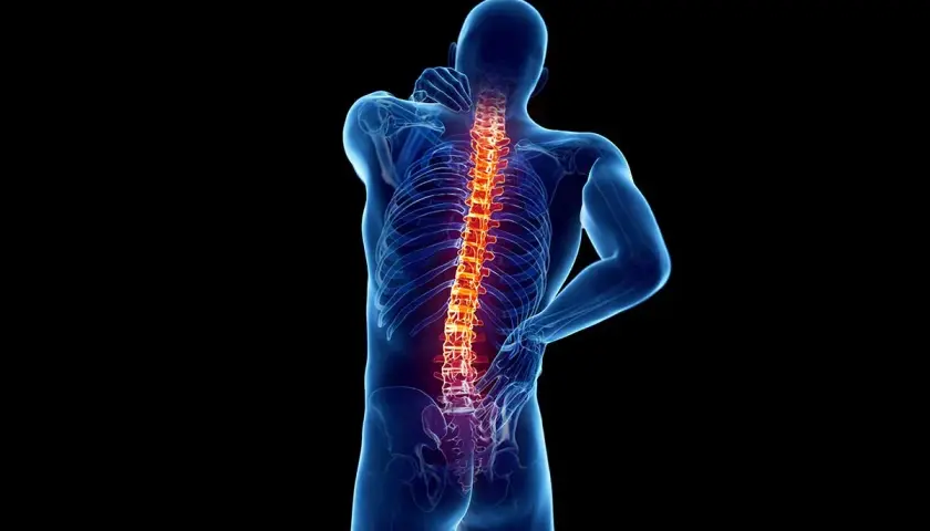 Ból kręgosłupa, który może być objawem osteoartrozy. Co to jest i jak sobie z tym radzić?