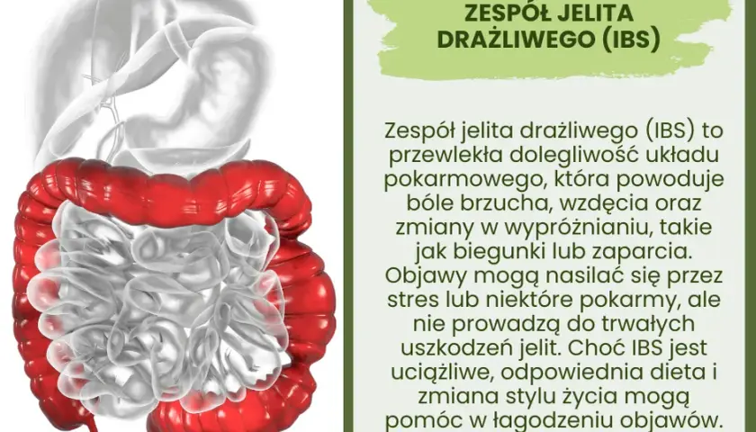 Jelito drażliwe - charakterystyczne objawy zespołu
