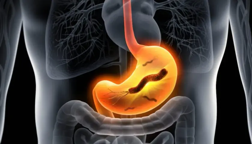Helicobacter pylori w kale: Co oznacza pozytywny wynik testu?