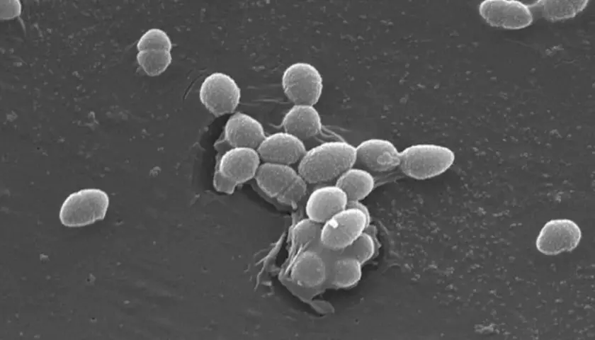 Enterococcus faecalis w moczu: Jak leczyć? Skuteczne metody