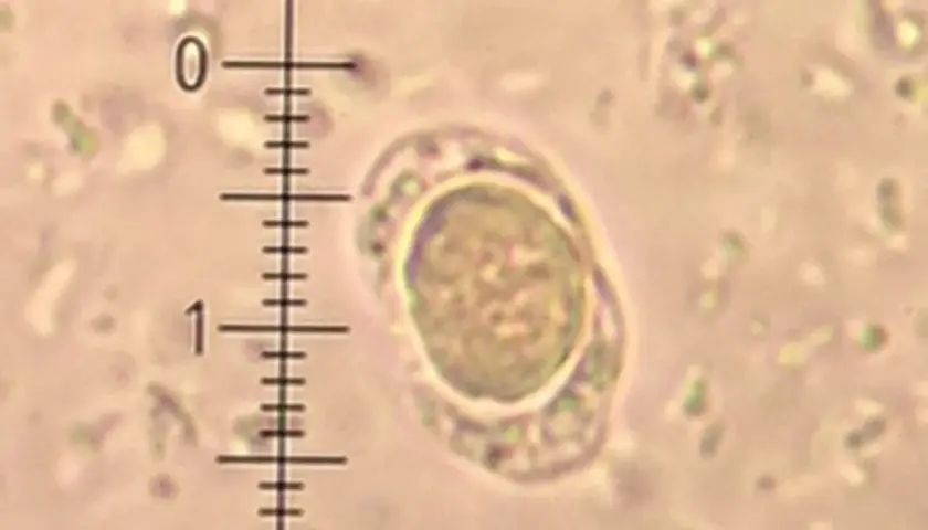 Blastocystis hominis - charakterystyka, objawy i naturalne leczenie