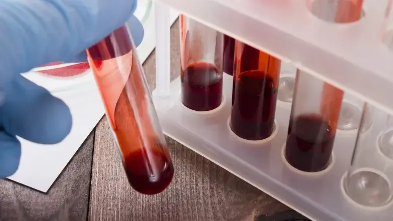 Badanie krwi po antybiotyku - o czym należy pamiętać?