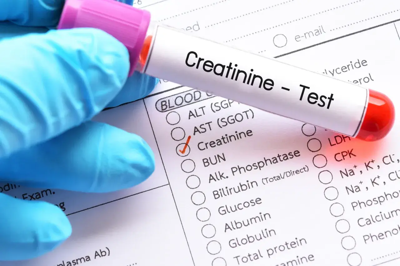 Rękawiczka w niebieskiej rękawiczce trzyma probówkę z napisem "Creatinine - Test". Obok zaznaczono "Creatinine" na formularzu badania krwi.