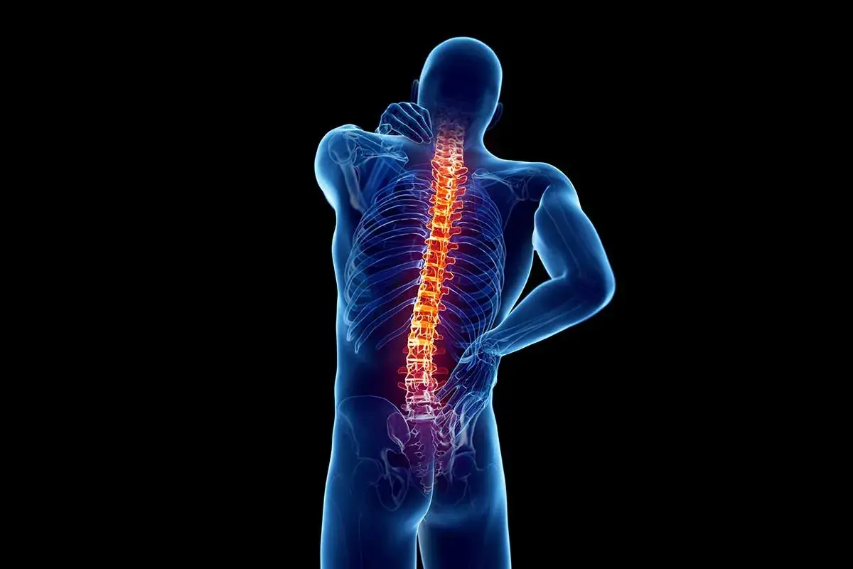 Ból kręgosłupa, który może być objawem osteoartrozy. Co to jest i jak sobie z tym radzić?